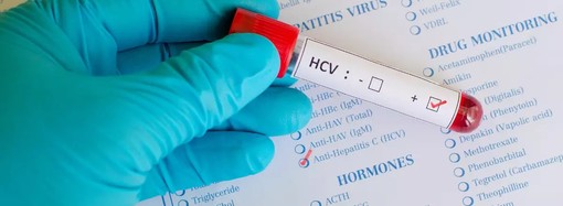 Comunidade do Heliópolis terá projeto - Hepatite C Pode Estar ao Seu Redor
